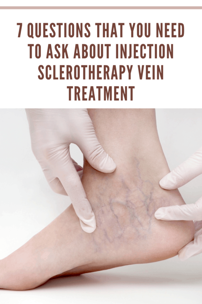 Questions That You Need To Ask About Injection Sclerotherapy Vein