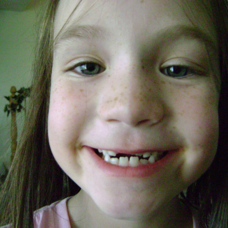 mackenzie loses a tooth