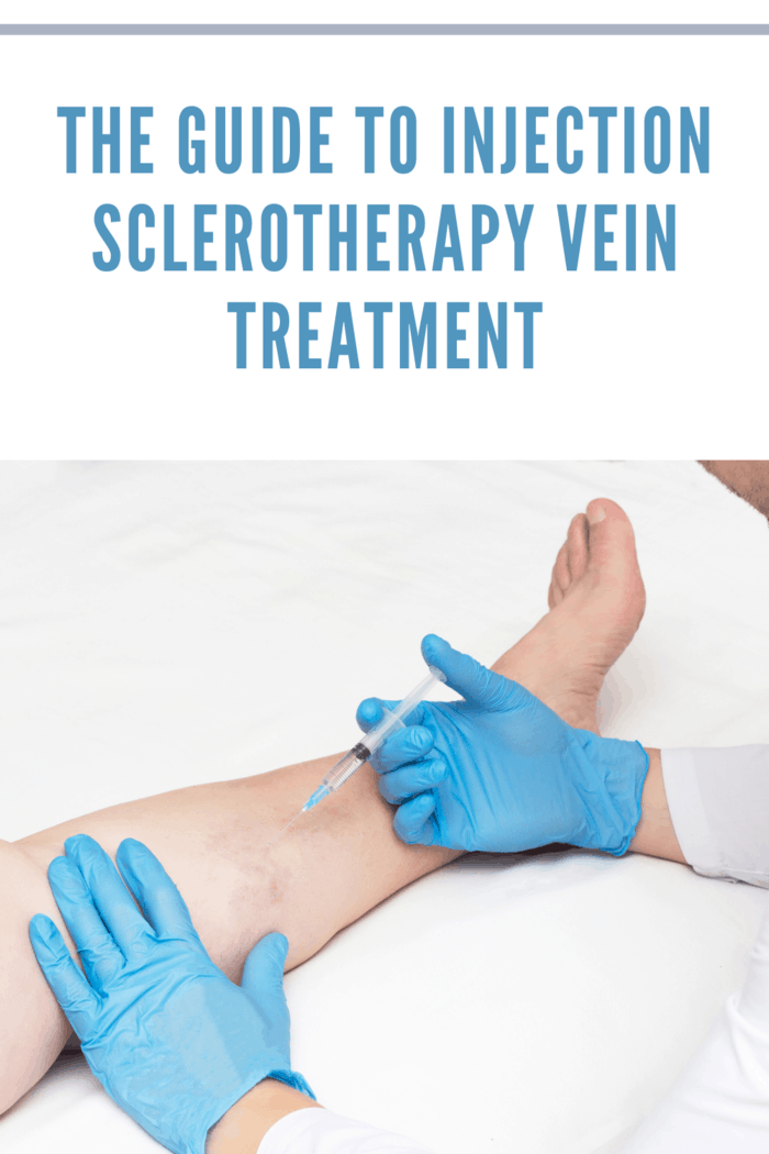 Doctor performs sclerotherapy for varicose veins on the legs, varicose vein treatment, copy space