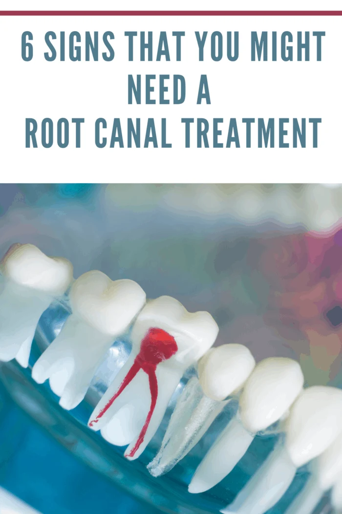 dental sample showing root canal in red