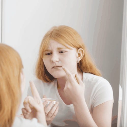 teen girl examines acne on face in front of mirror