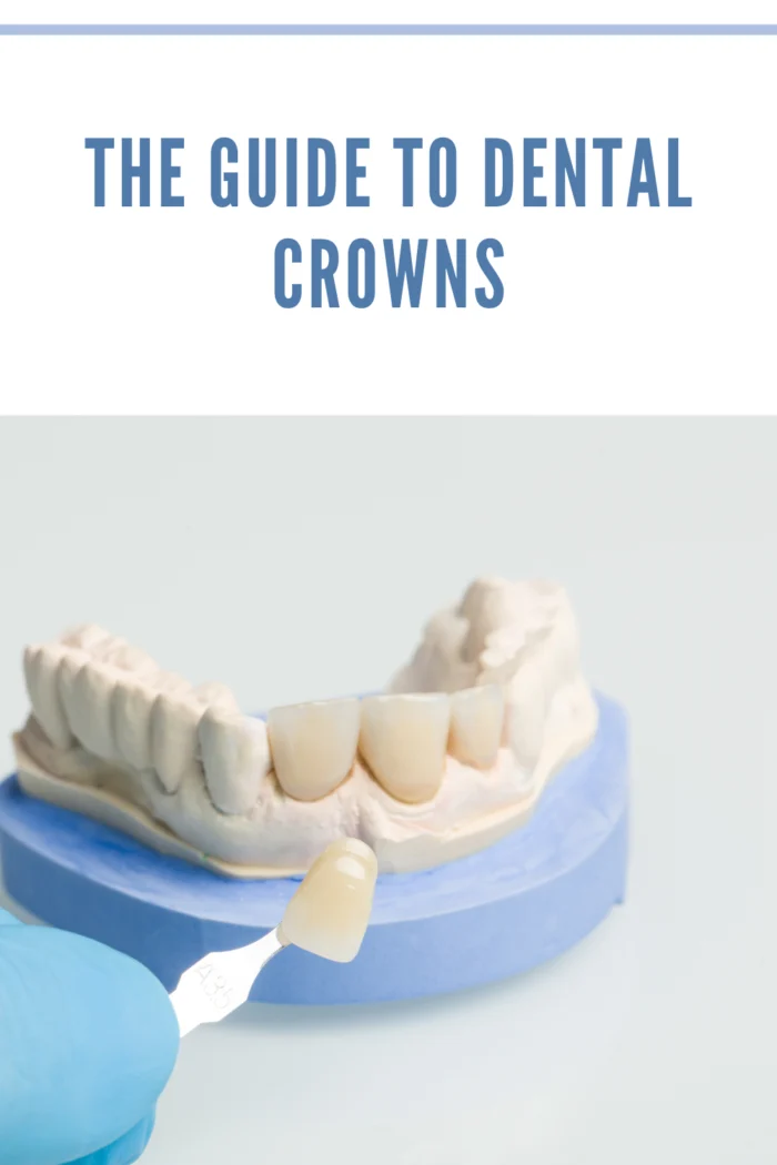 check veneer color of dental crown