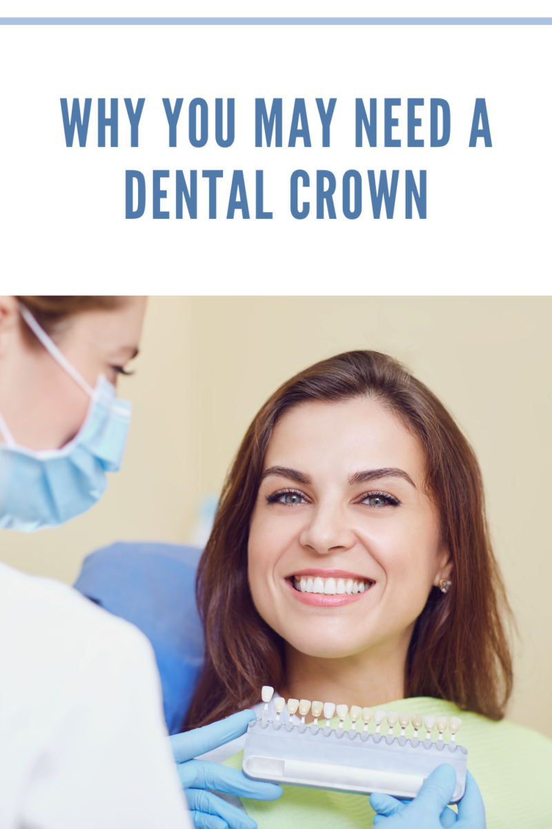 The Guide to Dental Crowns • Mommy's Memorandum