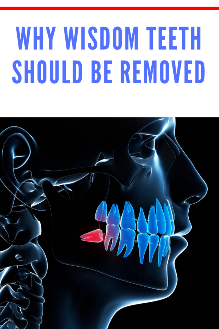 The problem with wisdom teeth is that they start growing when the rest of the teeth are fully established. As such, there is usually no adequate space left for them. Therefore, they try to invade the space occupied by the nearby teeth.