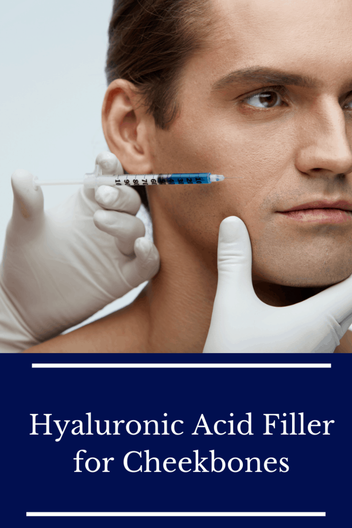 Hyaluronic acid can be used to emphasize and accentuate your cheekbones.