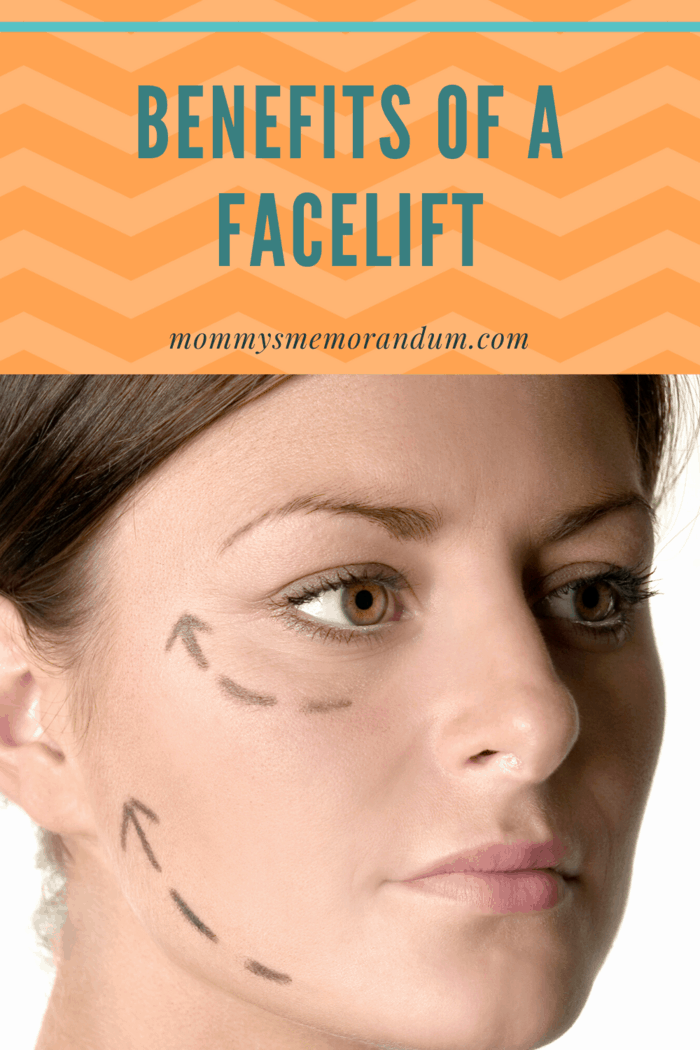 face marked for facelift