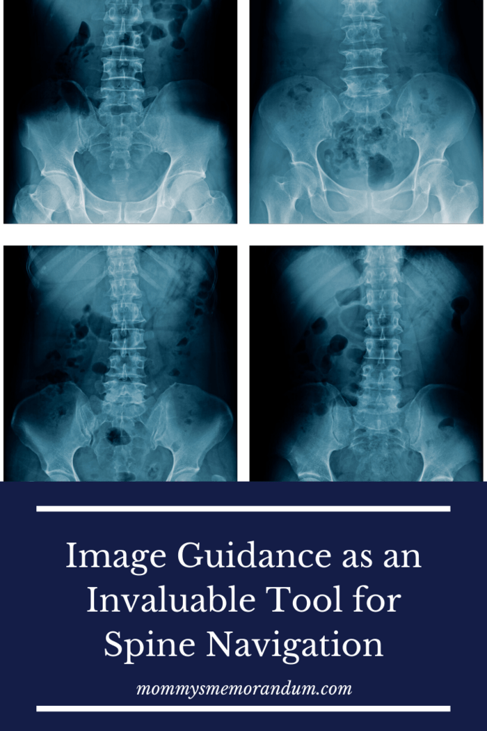Image-guided navigation is used for numerous surgical procedures across the medical field.