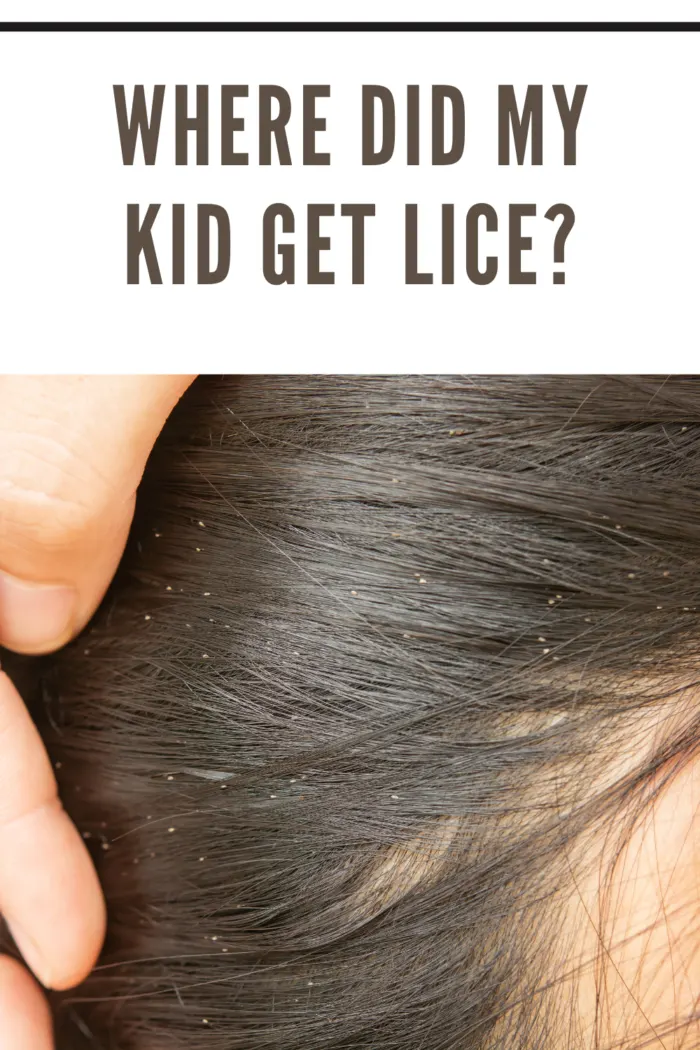 lice in hair