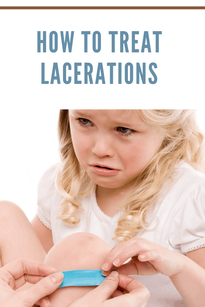how to treat lacerations