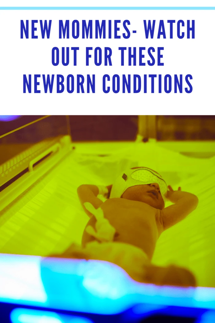 newborn with neonatal jaundice being treated under lights.