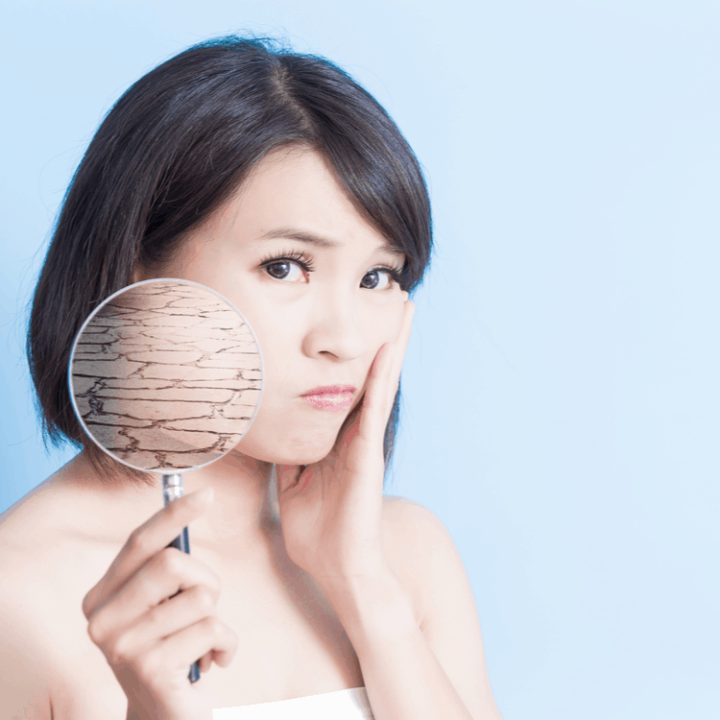 asian woman holding up magnifying glass showing dry skin in winter