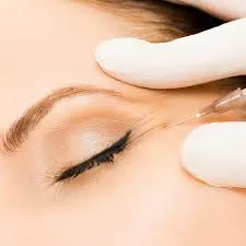 Closeup of botox injection in wrinkle near eye for mid adult woman with doctor addressing how long botox lasts around the eyes