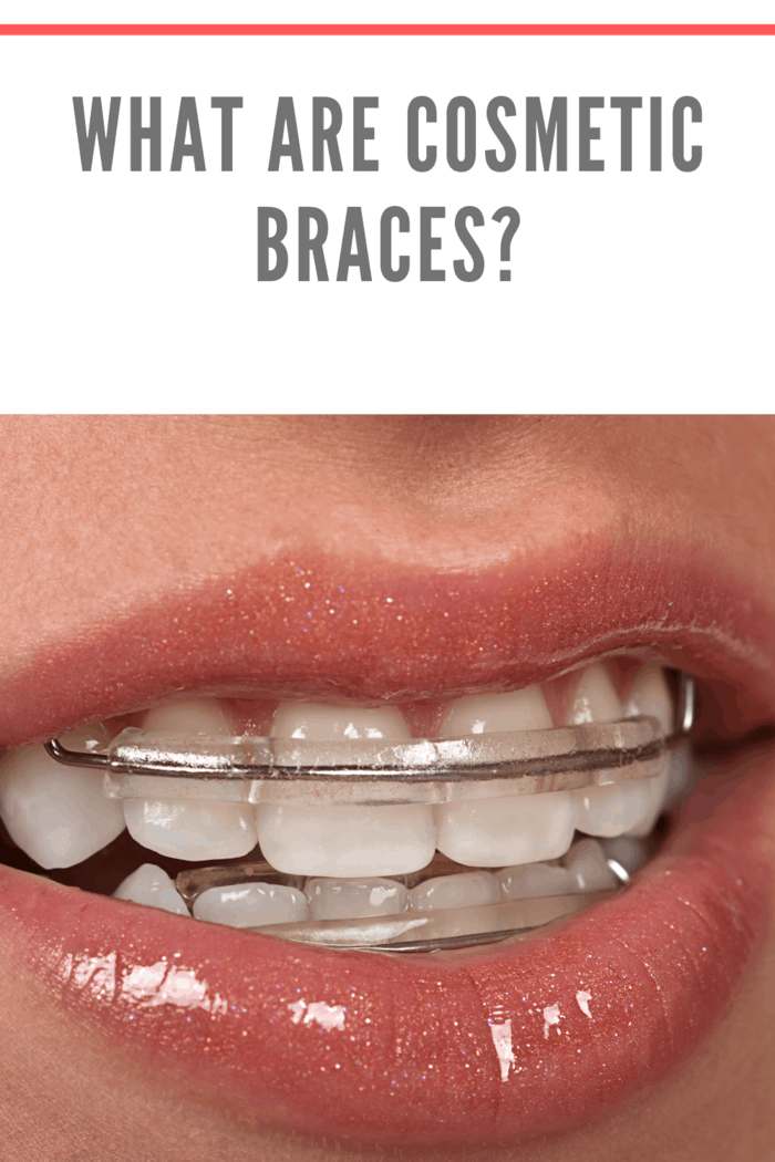 Close-up of cosmetic braces showing clear and ceramic options designed for a less noticeable look