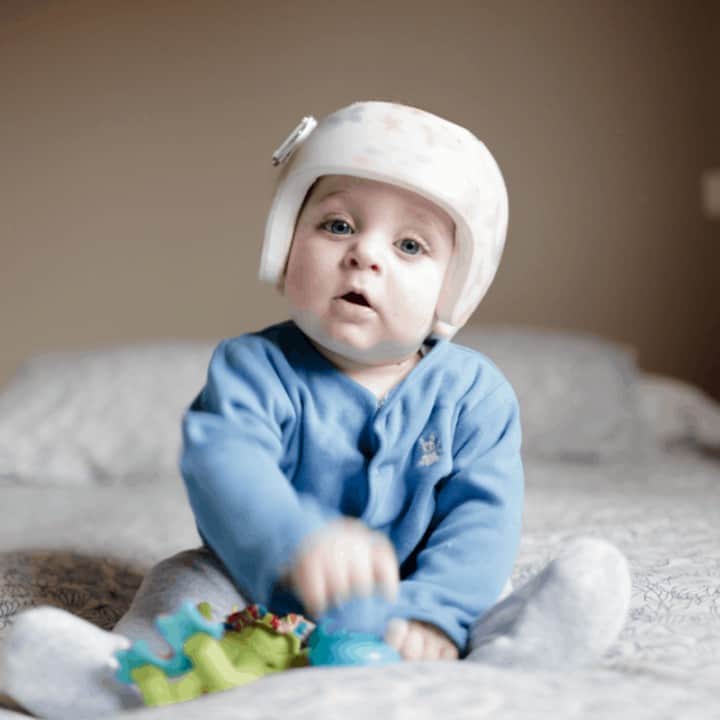cute baby boy 6 months old looking at camera. He is wearing a helmet to correct plagiocephaly and he is playing with a green toy while wearing a blue jaket