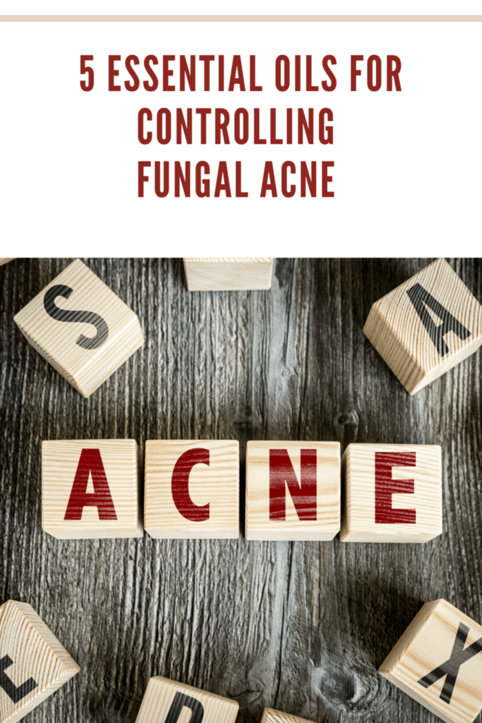 5 Essential Oils For Controlling Fungal Acne