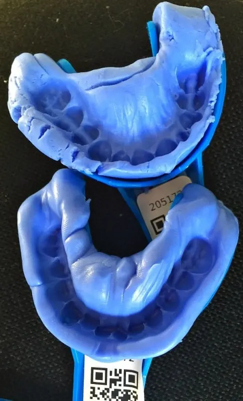 smile brilliant mold